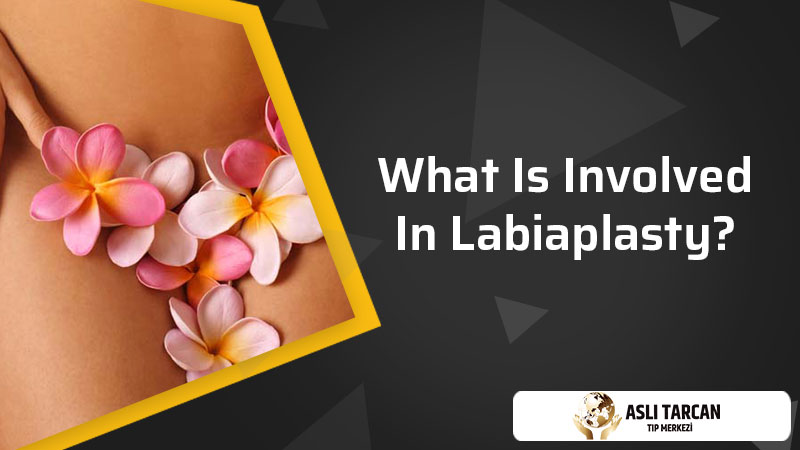 What Is Involved In Labiaplasty?