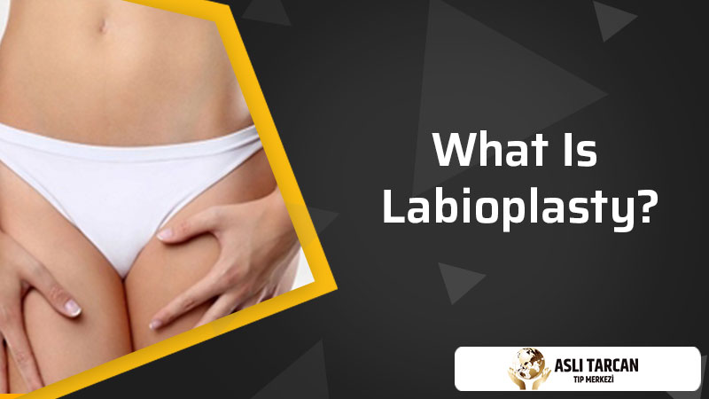 What Is Labioplasty?