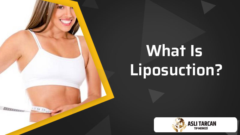 What Is Liposuction?