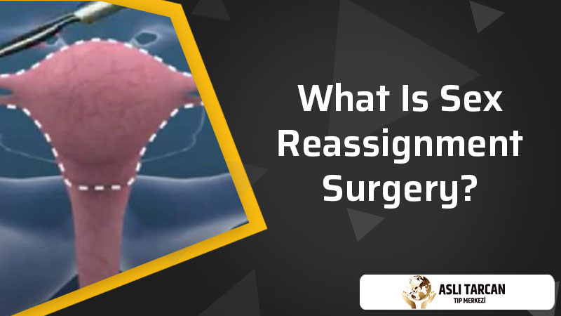 What Is Sex Reassignment Surgery?