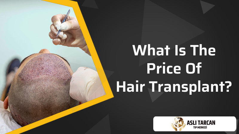 What Is The Price of Hair Transplant?