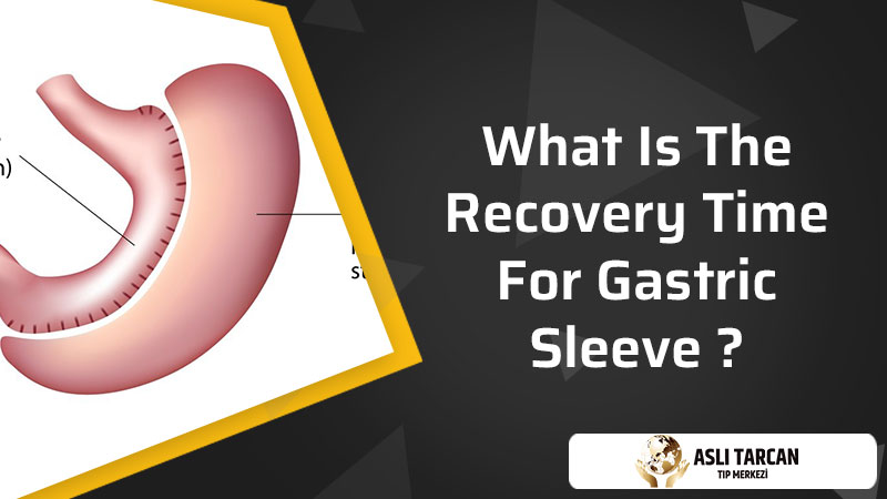 What Is The Recovery Time For Gastric Sleeve
