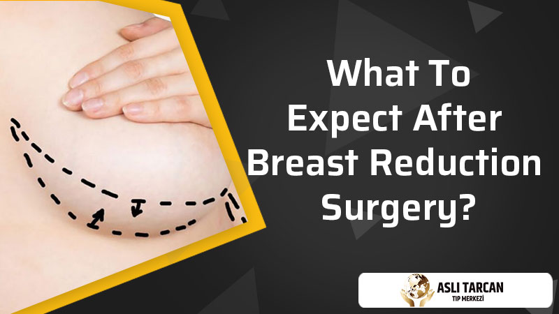 What To Expect After Breast Reduction Surgery?