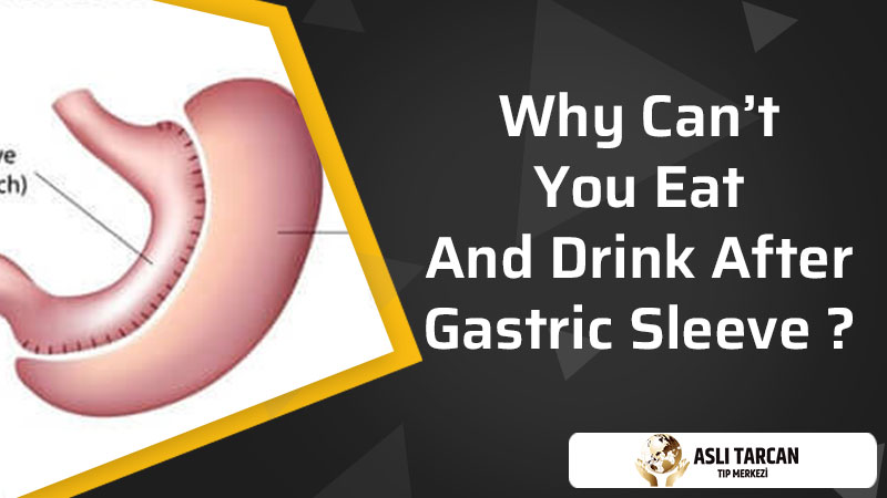 Why Can't You Eat And Drink After Gastric Sleeve