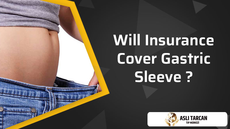 Will Insurance Cover Gastric Sleeve